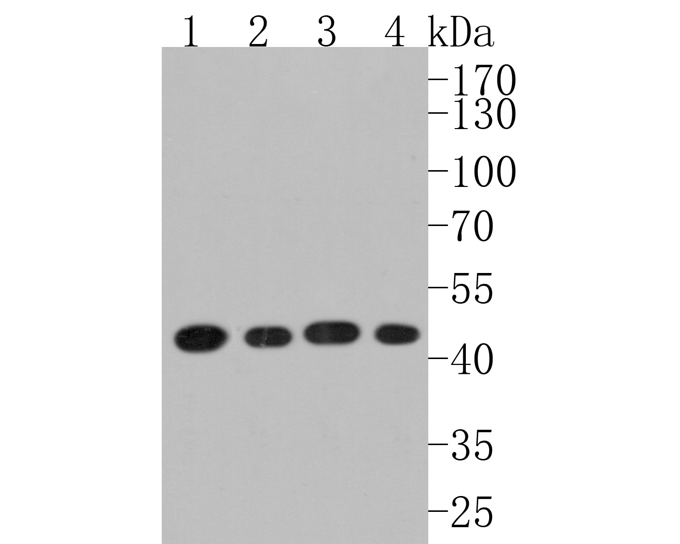 Western blot analysis of SCD1 on different lysates. Proteins were transferred to a PVDF membrane and blocked with 5% BSA in PBS for 1 hour at room temperature. The primary antibody (HA500119, 1/1,000) was used in 5% BSA at room temperature for 2 hours. Goat Anti-Rabbit IgG - HRP Secondary Antibody (HA1001) at 1:200,000 dilution was used for 1 hour at room temperature.<br />
Positive control: <br />
Lane 1: HepG2 cell lysate<br />
Lane 2: 293 cell lysate<br />
Lane 3: Hela cell lysate<br />
Lane 4: A549 cell lysate