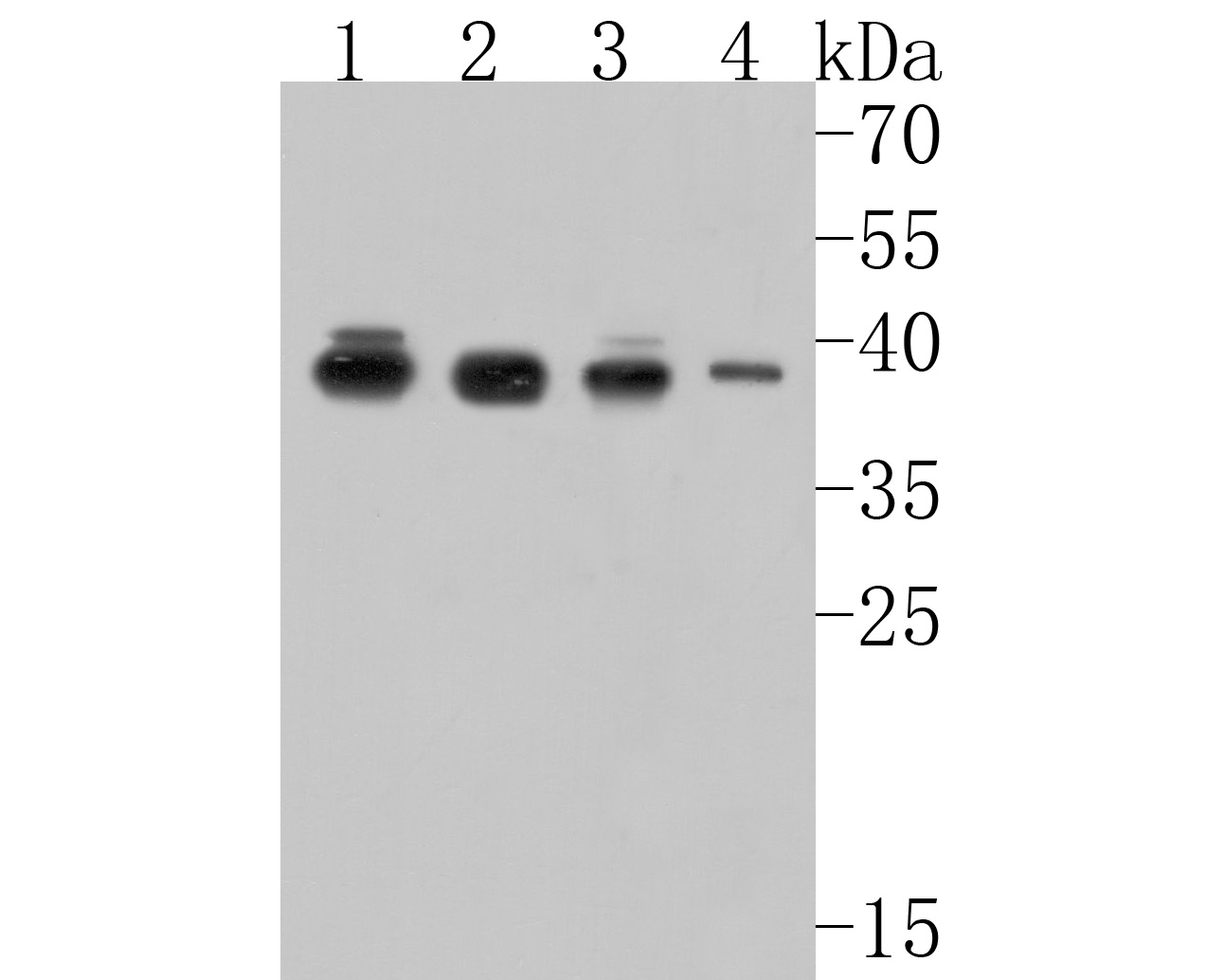 Western blot analysis of PPP2R4 on different lysates. Proteins were transferred to a PVDF membrane and blocked with 5% BSA in PBS for 1 hour at room temperature. The primary antibody (HA500123, 1/5,000) was used in 5% BSA at room temperature for 2 hours. Goat Anti-Rabbit IgG - HRP Secondary Antibody (HA1001) at 1:200,000 dilution was used for 1 hour at room temperature.<br />
Positive control: <br />
Lane 1: MCF-7 cell lysate<br />
Lane 2: SK-Br-3 cell lysate<br />
Lane 3: SiHa cell lysate<br />
Lane 4: Mouse brain tissue lysate