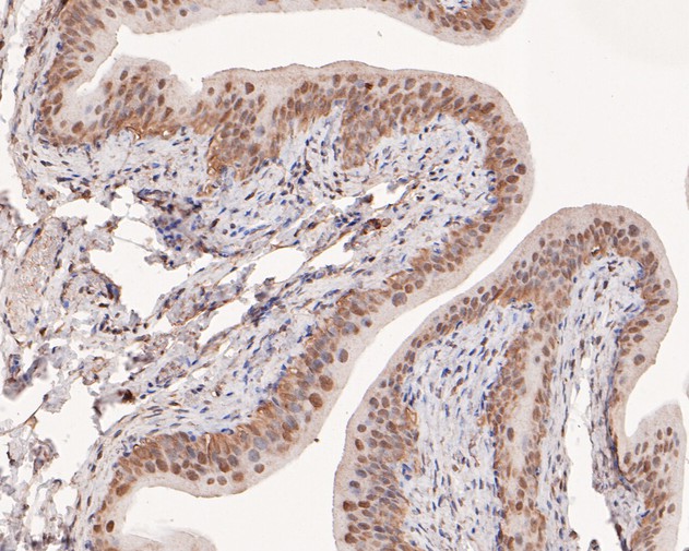 Immunohistochemical analysis of paraffin-embedded rat bladder tissue using anti-PPP2R4 antibody. The section was pre-treated using heat mediated antigen retrieval with sodium citrate buffer (pH 6.0) for 20 minutes. The tissues were blocked in 5% BSA for 30 minutes at room temperature, washed with ddH2O and PBS, and then probed with the primary antibody (HA500123, 1/400)  for 30 minutes at room temperature. The detection was performed using an HRP conjugated compact polymer system. DAB was used as the chromogen. Tissues were counterstained with hematoxylin and mounted with DPX.