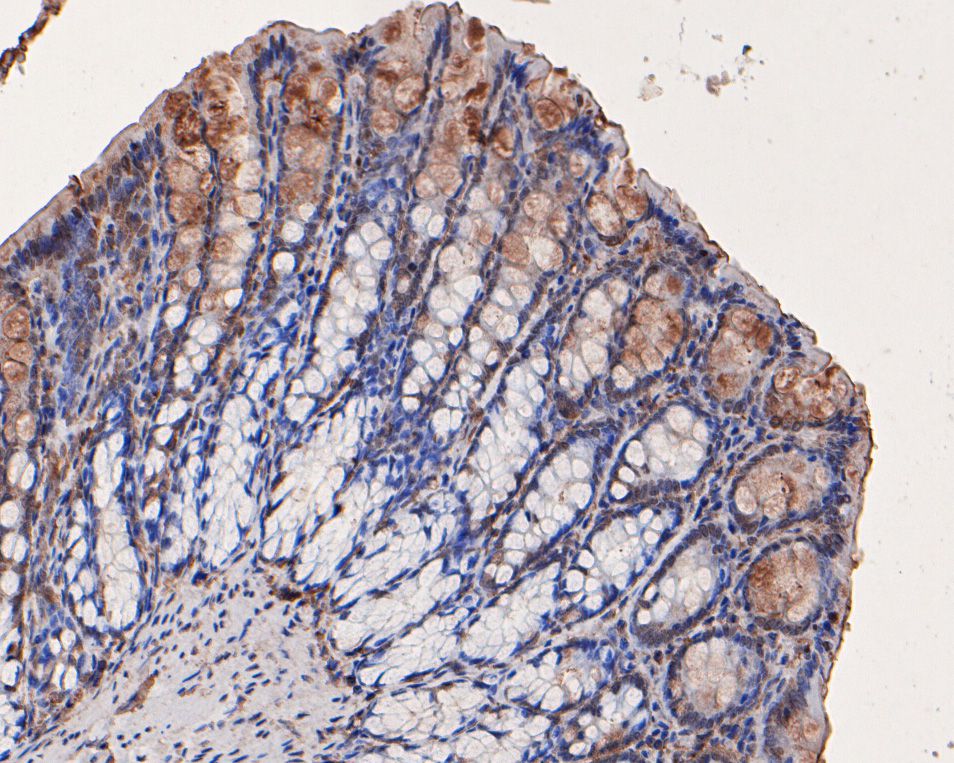 Immunohistochemical analysis of paraffin-embedded rat large intestine tissue using anti-FAM13C1 antibody. The section was pre-treated using heat mediated antigen retrieval with Tris-EDTA buffer (pH 8.0-8.4) for 20 minutes.The tissues were blocked in 5% BSA for 30 minutes at room temperature, washed with ddH2O and PBS, and then probed with the primary antibody (HA500122, 1/100) for 30 minutes at room temperature. The detection was performed using an HRP conjugated compact polymer system. DAB was used as the chromogen. Tissues were counterstained with hematoxylin and mounted with DPX.