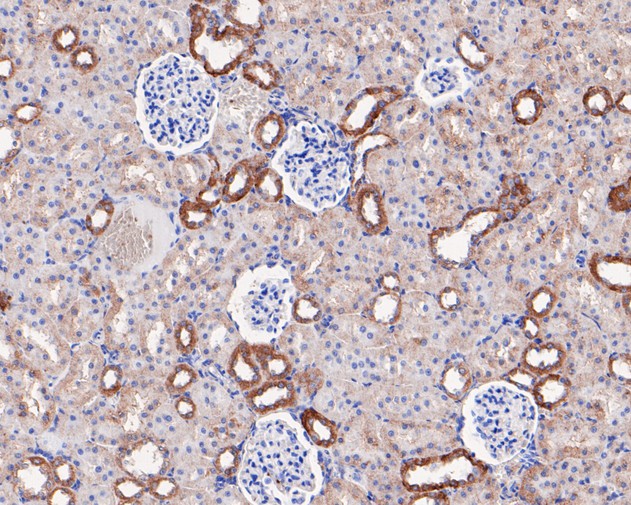 Immunohistochemical analysis of paraffin-embedded rat kidney tissue using anti-Caspase-12 antibody. The section was pre-treated using heat mediated antigen retrieval with Tris-EDTA buffer (pH 8.0-8.4) for 20 minutes.The tissues were blocked in 5% BSA for 30 minutes at room temperature, washed with ddH2O and PBS, and then probed with the primary antibody (HA500144, 1/400) for 30 minutes at room temperature. The detection was performed using an HRP conjugated compact polymer system. DAB was used as the chromogen. Tissues were counterstained with hematoxylin and mounted with DPX.