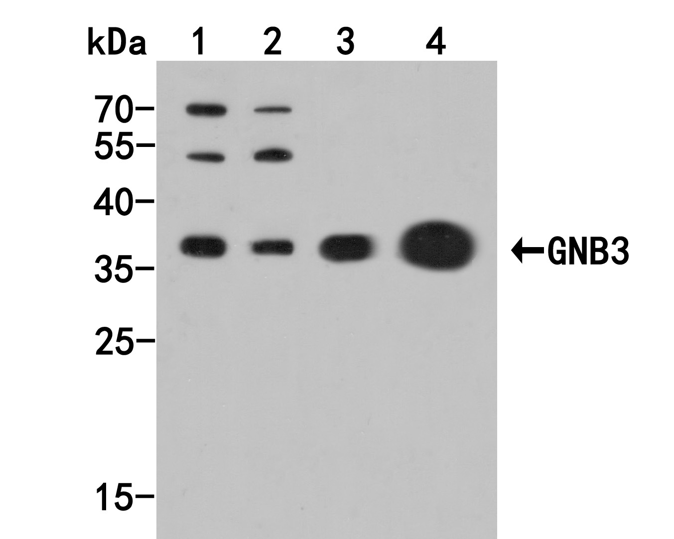 Western blot analysis of GNB3 on different lysates. Proteins were transferred to a PVDF membrane and blocked with 5% BSA in PBS for 1 hour at room temperature. The primary antibody (HA500127, 1/1,000) was used in 5% BSA at room temperature for 2 hours. Goat Anti-Rabbit IgG - HRP Secondary Antibody (HA1001) at 1:200,000 dilution was used for 1 hour at room temperature.<br />
Positive control: <br />
Lane 1: HepG2 cell lysate<br />
Lane 2: A549 cell lysate<br />
Lane 3: Mouse kidney tissue lysate<br />
Lane 4: Rat brian tissue lysate