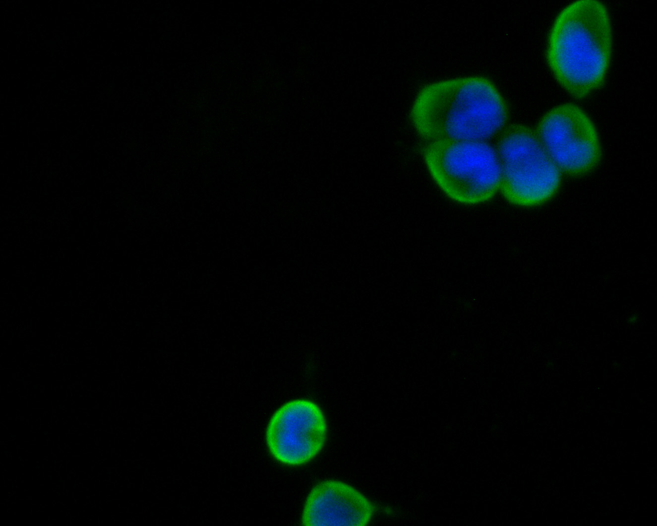 ICC staining of GNB3 in F9 cells (green). Formalin fixed cells were permeabilized with 0.1% Triton X-100 in TBS for 10 minutes at room temperature and blocked with 1% Blocker BSA for 15 minutes at room temperature. Cells were probed with the primary antibody (HA500127, 1/50) for 1 hour at room temperature, washed with PBS. Alexa Fluor®488 Goat anti-Rabbit IgG was used as the secondary antibody at 1/1,000 dilution. The nuclear counter stain is DAPI (blue).