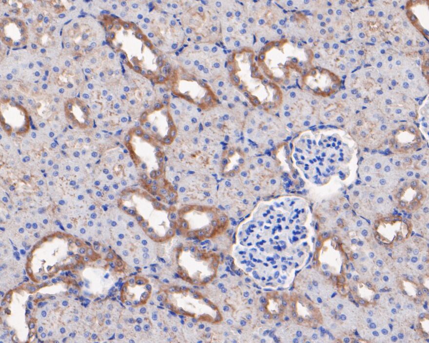 Immunohistochemical analysis of paraffin-embedded rat kidney tissue using anti-GNB3 antibody. The section was pre-treated using heat mediated antigen retrieval with Tris-EDTA buffer (pH 8.0-8.4) for 20 minutes.The tissues were blocked in 5% BSA for 30 minutes at room temperature, washed with ddH2O and PBS, and then probed with the primary antibody (HA500127, 1/400) for 30 minutes at room temperature. The detection was performed using an HRP conjugated compact polymer system. DAB was used as the chromogen. Tissues were counterstained with hematoxylin and mounted with DPX.
