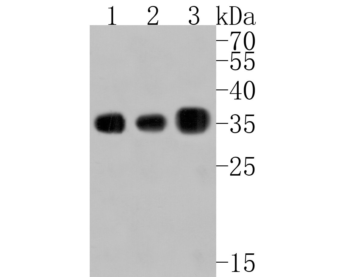 Western blot analysis of PP1C gamma on different lysates. Proteins were transferred to a PVDF membrane and blocked with 5% BSA in PBS for 1 hour at room temperature. The primary antibody (HA500138, 1/1,000) was used in 5% BSA at room temperature for 2 hours. Goat Anti-Rabbit IgG - HRP Secondary Antibody (HA1001) at 1:200,000 dilution was used for 1 hour at room temperature.<br />
Positive control: <br />
Lane 1: 293 cell lysate<br />
Lane 2: Mouse lung tissue lysate<br />
Lane 3: Rat brain tissue lysate