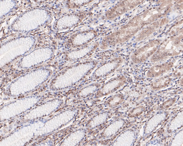 Immunohistochemical analysis of paraffin-embedded human stomach tissue using anti-PP1C gamma antibody. The section was pre-treated using heat mediated antigen retrieval with sodium citrate buffer (pH 6.0) for 20 minutes. The tissues were blocked in 5% BSA for 30 minutes at room temperature, washed with ddH2O and PBS, and then probed with the primary antibody (HA500138, 1/100)  for 30 minutes at room temperature. The detection was performed using an HRP conjugated compact polymer system. DAB was used as the chromogen. Tissues were counterstained with hematoxylin and mounted with DPX.
