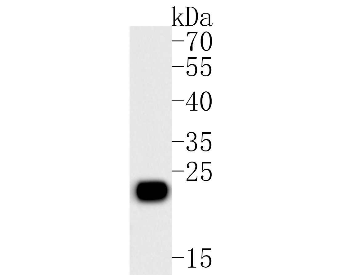 Western blot analysis of Placental lactogen on human placenta tissue lysates. Proteins were transferred to a PVDF membrane and blocked with 5% BSA in PBS for 1 hour at room temperature. The primary antibody (HA500128, 1/5,000) was used in 5% BSA at room temperature for 2 hours. Goat Anti-Rabbit IgG - HRP Secondary Antibody (HA1001) at 1:40,000 dilution was used for 1 hour at room temperature.