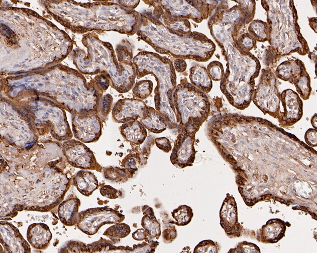 Immunohistochemical analysis of paraffin-embedded human placenta tissue using anti-Placental lactogen antibody. The section was pre-treated using heat mediated antigen retrieval with Tris-EDTA buffer (pH 8.0-8.4) for 20 minutes.The tissues were blocked in 5% BSA for 30 minutes at room temperature, washed with ddH2O and PBS, and then probed with the primary antibody (HA500128, 1/800) for 30 minutes at room temperature. The detection was performed using an HRP conjugated compact polymer system. DAB was used as the chromogen. Tissues were counterstained with hematoxylin and mounted with DPX.