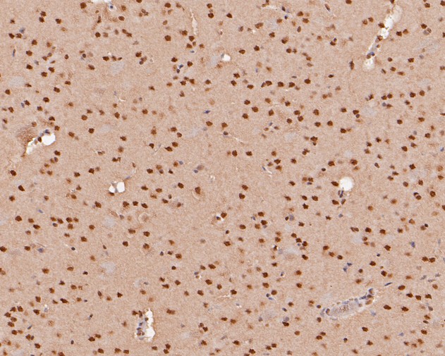 Immunohistochemical analysis of paraffin-embedded mouse brain tissue using anti-THOC5 antibody. The section was pre-treated using heat mediated antigen retrieval with sodium citrate buffer (pH 6.0) for 20 minutes. The tissues were blocked in 5% BSA for 30 minutes at room temperature, washed with ddH2O and PBS, and then probed with the primary antibody (HA500129, 1/200)  for 30 minutes at room temperature. The detection was performed using an HRP conjugated compact polymer system. DAB was used as the chromogen. Tissues were counterstained with hematoxylin and mounted with DPX.