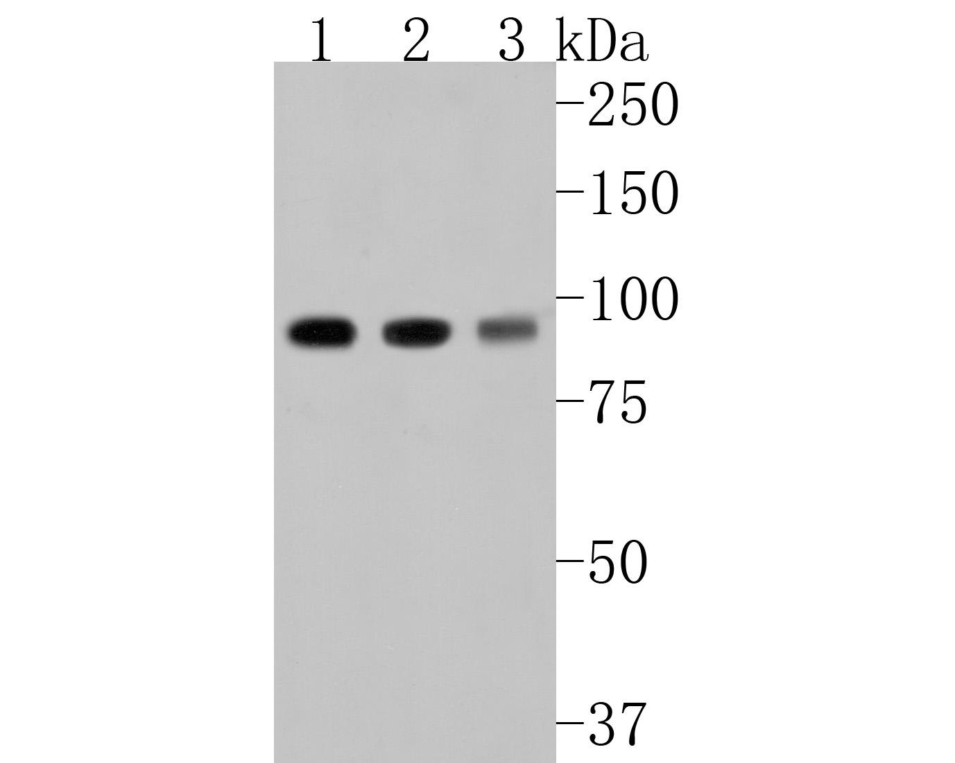Western blot analysis of Beta-galactosidase on different lysates. Proteins were transferred to a PVDF membrane and blocked with 5% BSA in PBS for 1 hour at room temperature. The primary antibody (HA500132, 1/500) was used in 5% BSA at room temperature for 2 hours. Goat Anti-Rabbit IgG - HRP Secondary Antibody (HA1001) at 1:40,000 dilution was used for 1 hour at room temperature.<br />
Positive control: <br />
Lane 1: MCF-7 cell lysate<br />
Lane 2: Mouse pancreas tissue lysate<br />
Lane 3: Rat stomach tissue lysate