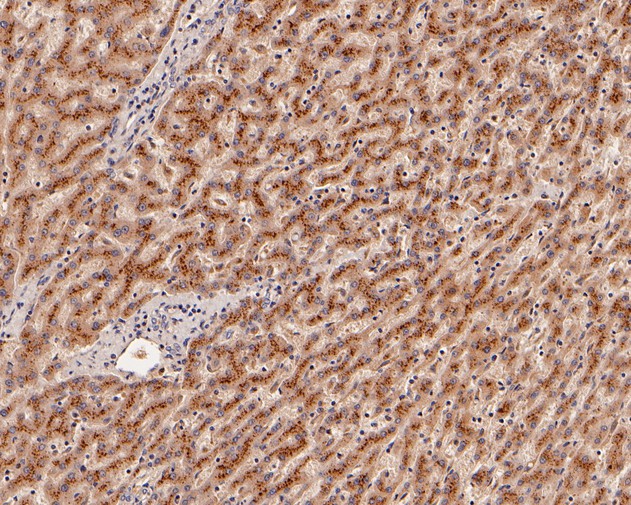 Immunohistochemical analysis of paraffin-embedded human liver tissue using anti-Beta-galactosidase antibody. The section was pre-treated using heat mediated antigen retrieval with Tris-EDTA buffer (pH 8.0-8.4) for 20 minutes.The tissues were blocked in 5% BSA for 30 minutes at room temperature, washed with ddH2O and PBS, and then probed with the primary antibody (HA500132, 1/800) for 30 minutes at room temperature. The detection was performed using an HRP conjugated compact polymer system. DAB was used as the chromogen. Tissues were counterstained with hematoxylin and mounted with DPX.