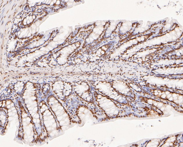 Immunohistochemical analysis of paraffin-embedded rat large intestine tissue using anti-XPA antibody. The section was pre-treated using heat mediated antigen retrieval with sodium citrate buffer (pH 6.0) for 20 minutes. The tissues were blocked in 5% BSA for 30 minutes at room temperature, washed with ddH2O and PBS, and then probed with the primary antibody (HA500133, 1/400)  for 30 minutes at room temperature. The detection was performed using an HRP conjugated compact polymer system. DAB was used as the chromogen. Tissues were counterstained with hematoxylin and mounted with DPX.