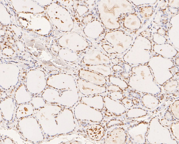 Immunohistochemical analysis of paraffin-embedded human thyroid tissue using anti-XPA antibody. The section was pre-treated using heat mediated antigen retrieval with sodium citrate buffer (pH 6.0) for 20 minutes. The tissues were blocked in 5% BSA for 30 minutes at room temperature, washed with ddH2O and PBS, and then probed with the primary antibody (HA500133, 1/400)  for 30 minutes at room temperature. The detection was performed using an HRP conjugated compact polymer system. DAB was used as the chromogen. Tissues were counterstained with hematoxylin and mounted with DPX.