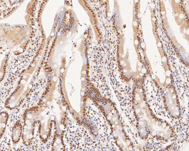 Immunohistochemical analysis of paraffin-embedded human small intestine tissue using anti-XPA antibody. The section was pre-treated using heat mediated antigen retrieval with sodium citrate buffer (pH 6.0) for 20 minutes. The tissues were blocked in 5% BSA for 30 minutes at room temperature, washed with ddH2O and PBS, and then probed with the primary antibody (HA500133, 1/400)  for 30 minutes at room temperature. The detection was performed using an HRP conjugated compact polymer system. DAB was used as the chromogen. Tissues were counterstained with hematoxylin and mounted with DPX.