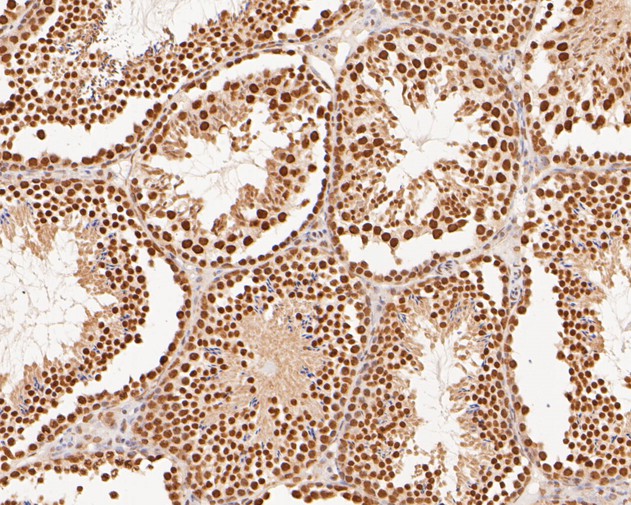 Immunohistochemical analysis of paraffin-embedded mouse testis tissue using anti-XPA antibody. The section was pre-treated using heat mediated antigen retrieval with sodium citrate buffer (pH 6.0) for 20 minutes. The tissues were blocked in 5% BSA for 30 minutes at room temperature, washed with ddH2O and PBS, and then probed with the primary antibody (HA500133, 1/400)  for 30 minutes at room temperature. The detection was performed using an HRP conjugated compact polymer system. DAB was used as the chromogen. Tissues were counterstained with hematoxylin and mounted with DPX.