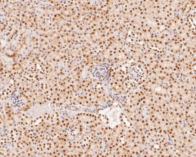Immunohistochemical analysis of paraffin-embedded mouse kidney tissue using anti-XPA antibody. The section was pre-treated using heat mediated antigen retrieval with sodium citrate buffer (pH 6.0) for 20 minutes. The tissues were blocked in 5% BSA for 30 minutes at room temperature, washed with ddH2O and PBS, and then probed with the primary antibody (HA500133, 1/400)  for 30 minutes at room temperature. The detection was performed using an HRP conjugated compact polymer system. DAB was used as the chromogen. Tissues were counterstained with hematoxylin and mounted with DPX.