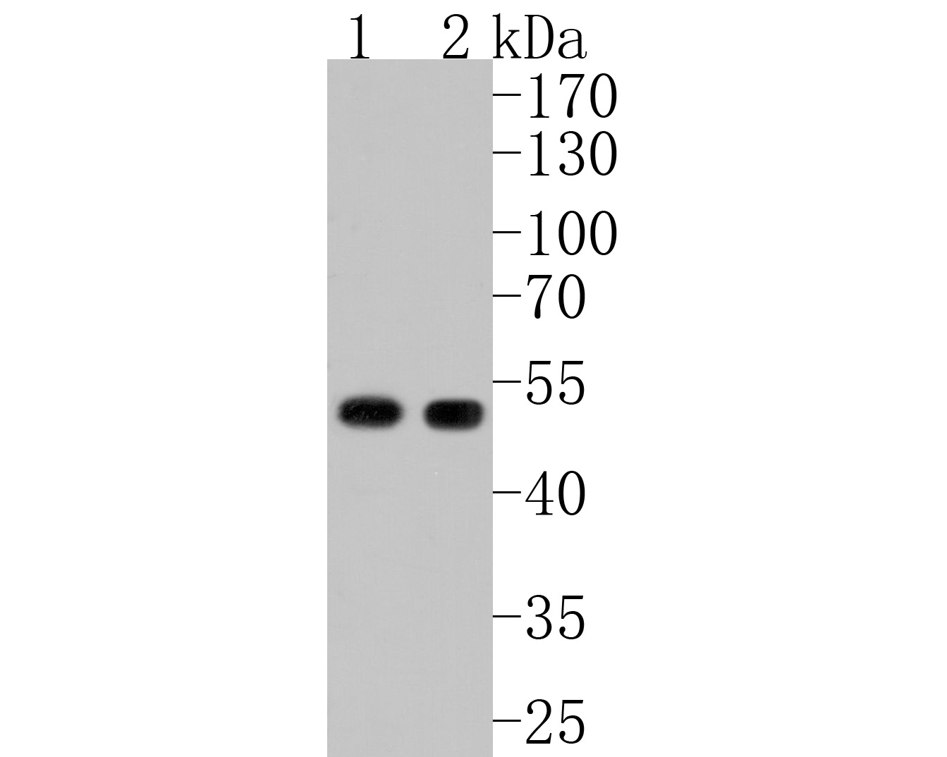 Western blot analysis of PAI1 on different lysates. Proteins were transferred to a PVDF membrane and blocked with 5% BSA in PBS for 1 hour at room temperature. The primary antibody (HA500124, 1/1,000) was used in 5% BSA at room temperature for 2 hours. Goat Anti-Rabbit IgG - HRP Secondary Antibody (HA1001) at 1:200,000 dilution was used for 1 hour at room temperature.<br />
Positive control: <br />
Lane 1: Rat brain tissue lysate<br />
Lane 2: Rat cerebellum tissue lysate