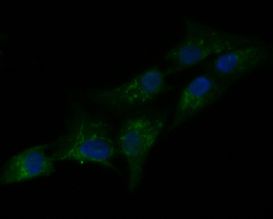 ICC staining of PAI1 in MG-63 cells (green). Formalin fixed cells were permeabilized with 0.1% Triton X-100 in TBS for 10 minutes at room temperature and blocked with 1% Blocker BSA for 15 minutes at room temperature. Cells were probed with the primary antibody (HA500124, 1/50) for 1 hour at room temperature, washed with PBS. Alexa Fluor®488 Goat anti-Rabbit IgG was used as the secondary antibody at 1/1,000 dilution. The nuclear counter stain is DAPI (blue).