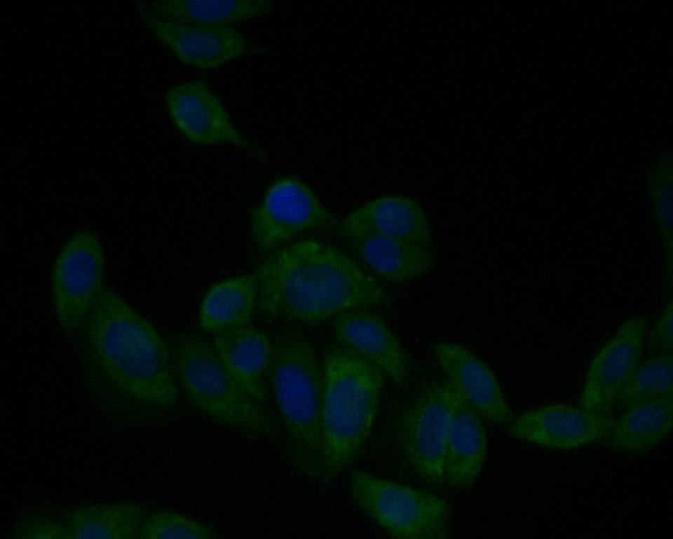 ICC staining of PAI1 in SiHa cells (green). Formalin fixed cells were permeabilized with 0.1% Triton X-100 in TBS for 10 minutes at room temperature and blocked with 1% Blocker BSA for 15 minutes at room temperature. Cells were probed with the primary antibody (HA500124, 1/50) for 1 hour at room temperature, washed with PBS. Alexa Fluor®488 Goat anti-Rabbit IgG was used as the secondary antibody at 1/1,000 dilution. The nuclear counter stain is DAPI (blue).