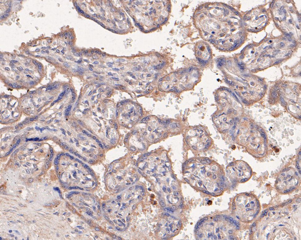 Immunohistochemical analysis of paraffin-embedded human placenta tissue using anti-PAI1 antibody. The section was pre-treated using heat mediated antigen retrieval with Tris-EDTA buffer (pH 8.0-8.4) for 20 minutes.The tissues were blocked in 5% BSA for 30 minutes at room temperature, washed with ddH2O and PBS, and then probed with the primary antibody (HA500124, 1/100) for 30 minutes at room temperature. The detection was performed using an HRP conjugated compact polymer system. DAB was used as the chromogen. Tissues were counterstained with hematoxylin and mounted with DPX.