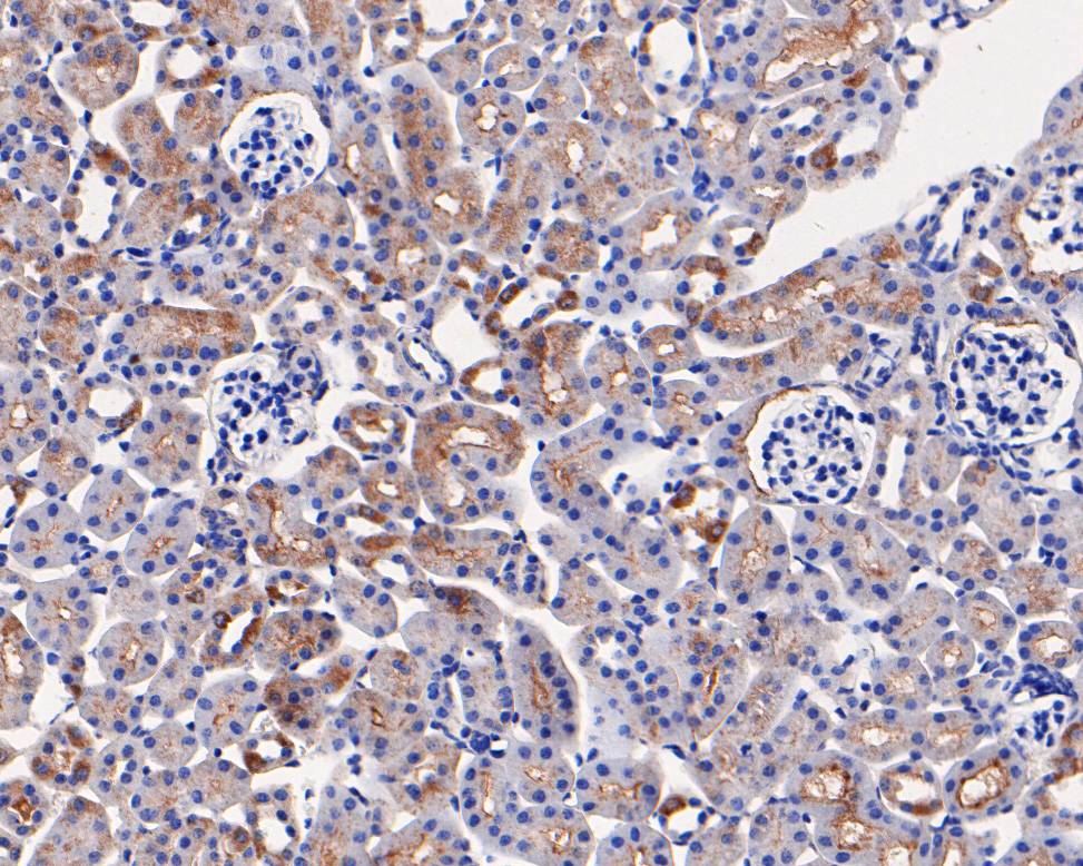 Immunohistochemical analysis of paraffin-embedded mouse kidney tissue using anti-PAI1 antibody. The section was pre-treated using heat mediated antigen retrieval with Tris-EDTA buffer (pH 8.0-8.4) for 20 minutes.The tissues were blocked in 5% BSA for 30 minutes at room temperature, washed with ddH2O and PBS, and then probed with the primary antibody (HA500124, 1/100) for 30 minutes at room temperature. The detection was performed using an HRP conjugated compact polymer system. DAB was used as the chromogen. Tissues were counterstained with hematoxylin and mounted with DPX.