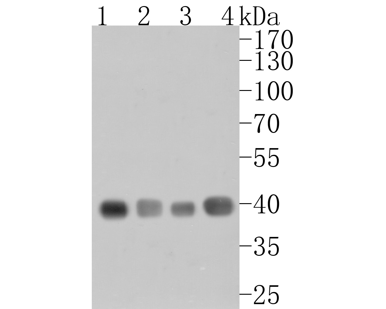 Western blot analysis of GNAO1 on different lysates. Proteins were transferred to a PVDF membrane and blocked with 5% BSA in PBS for 1 hour at room temperature. The primary antibody (HA500136, 1/5,000) was used in 5% BSA at room temperature for 2 hours. Goat Anti-Rabbit IgG - HRP Secondary Antibody (HA1001) at 1:200,000 dilution was used for 1 hour at room temperature.<br />
Positive control: <br />
Lane 1: Rat brain tissue lysate<br />
Lane 2: Mouse brain tissue lysate<br />
Lane 3: Mouse hippocampus tissue lysate<br />
Lane 4: Human brain tissue lysate