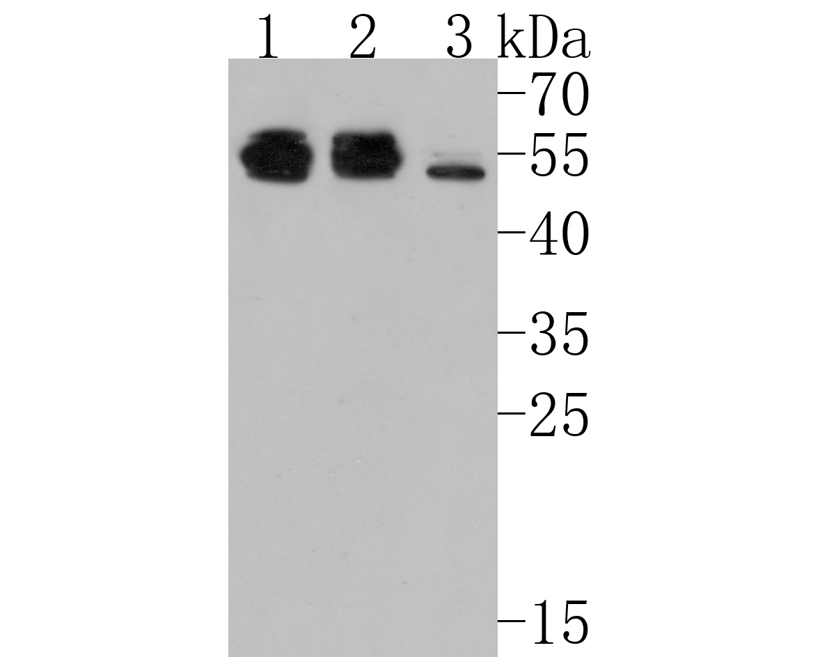 Western blot analysis of TNF Receptor I on different lysates. Proteins were transferred to a PVDF membrane and blocked with 5% BSA in PBS for 1 hour at room temperature. The primary antibody (HA500140, 1/1,000) was used in 5% BSA at room temperature for 2 hours. Goat Anti-Rabbit IgG - HRP Secondary Antibody (HA1001) at 1:200,000 dilution was used for 1 hour at room temperature.<br />
Positive control: <br />
Lane 1: A549 cell lysate<br />
Lane 2: Hela cell lysate<br />
Lane 3: HepG2 cell lysate