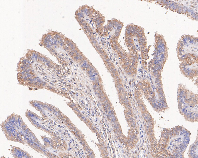 Immunohistochemical analysis of paraffin-embedded human fallopian tube tissue using anti-TNF Receptor I antibody. The section was pre-treated using heat mediated antigen retrieval with Tris-EDTA buffer (pH 8.0-8.4) for 20 minutes.The tissues were blocked in 5% BSA for 30 minutes at room temperature, washed with ddH2O and PBS, and then probed with the primary antibody (HA500140, 1/400) for 30 minutes at room temperature. The detection was performed using an HRP conjugated compact polymer system. DAB was used as the chromogen. Tissues were counterstained with hematoxylin and mounted with DPX.