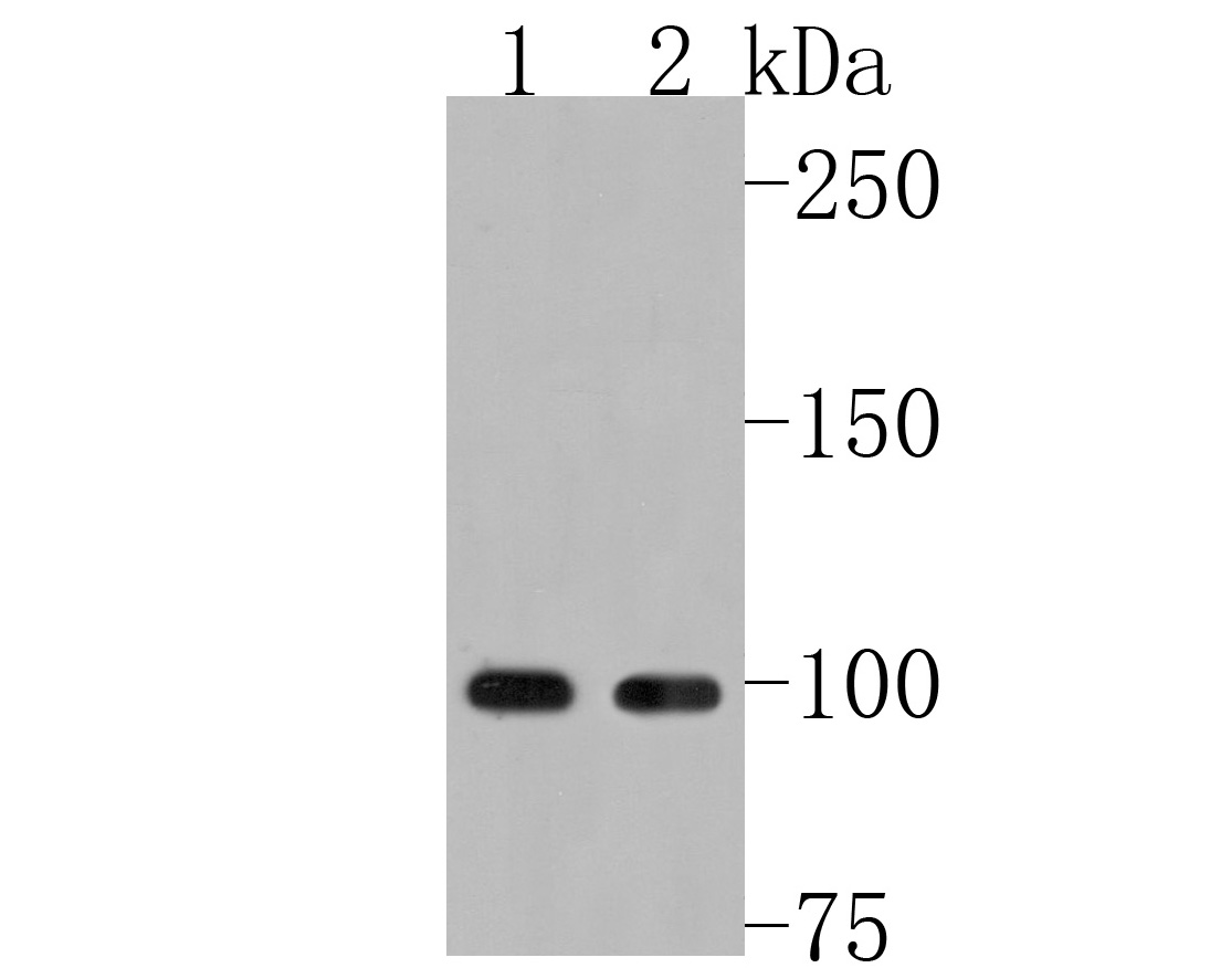 Western blot analysis of MCK10 on different lysates. Proteins were transferred to a PVDF membrane and blocked with 5% BSA in PBS for 1 hour at room temperature. The primary antibody (HA500141, 1/1,000) was used in 5% BSA at room temperature for 2 hours. Goat Anti-Rabbit IgG - HRP Secondary Antibody (HA1001) at 1:200,000 dilution was used for 1 hour at room temperature.<br />
Positive control: <br />
Lane 1: Rat brain tissue lysate<br />
Lane 2: Mouse brain tissue lysate