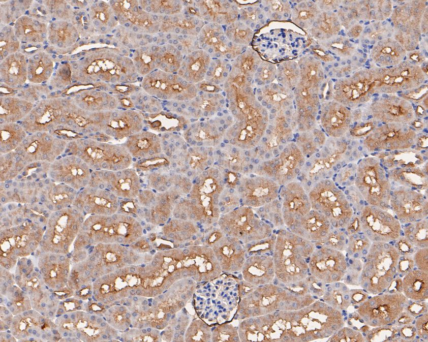 Immunohistochemical analysis of paraffin-embedded mouse kidney tissue using anti-MCK10 antibody. The section was pre-treated using heat mediated antigen retrieval with Tris-EDTA buffer (pH 8.0-8.4) for 20 minutes.The tissues were blocked in 5% BSA for 30 minutes at room temperature, washed with ddH2O and PBS, and then probed with the primary antibody (HA500141, 1/400) for 30 minutes at room temperature. The detection was performed using an HRP conjugated compact polymer system. DAB was used as the chromogen. Tissues were counterstained with hematoxylin and mounted with DPX.
