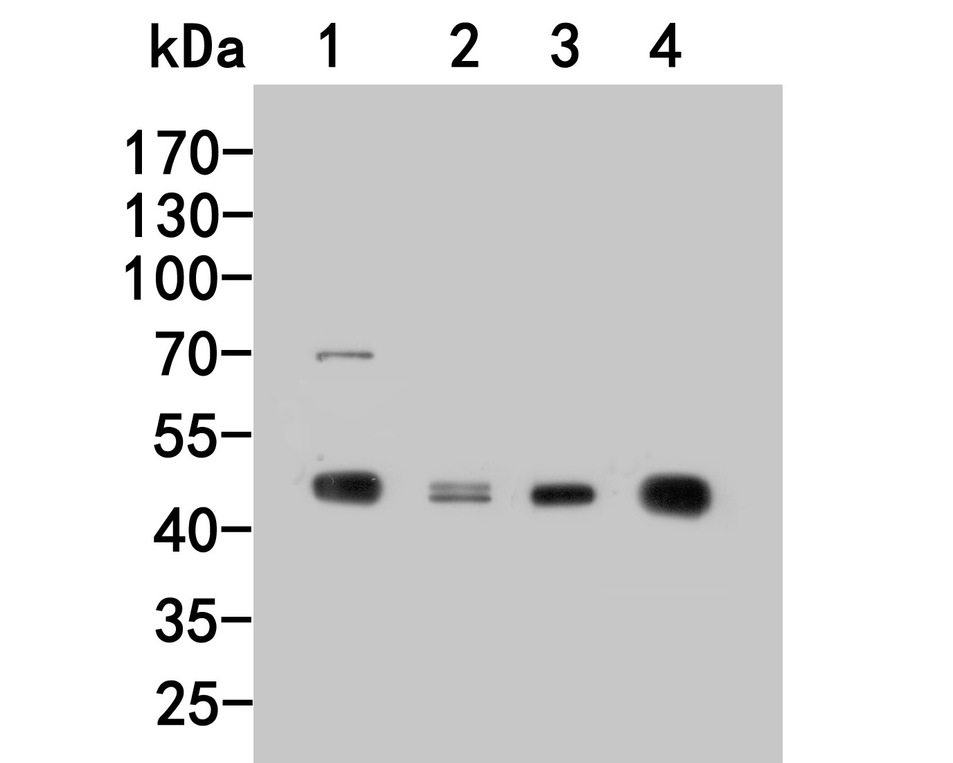 Western blot analysis of PIP5K2 gamma on different lysates. Proteins were transferred to a PVDF membrane and blocked with 5% BSA in PBS for 1 hour at room temperature. The primary antibody (HA500139, 1/1,000) was used in 5% BSA at room temperature for 2 hours. Goat Anti-Rabbit IgG - HRP Secondary Antibody (HA1001) at 1:200,000 dilution was used for 1 hour at room temperature.<br />
Positive control: <br />
Lane 1: MCF-7 cell lysate<br />
Lane 2: A549 cell lysate<br />
Lane 3: Rat cerebellum tissue lysate<br />
Lane 4: Mouse brain tissue lysate
