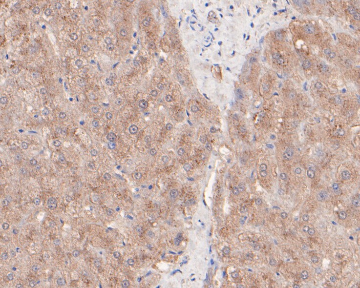 Immunohistochemical analysis of paraffin-embedded human liver tissue using anti-LKB1 antibody. The section was pre-treated using heat mediated antigen retrieval with sodium citrate buffer (pH 6.0) for 20 minutes. The tissues were blocked in 5% BSA for 30 minutes at room temperature, washed with ddH2O and PBS, and then probed with the primary antibody (HA500143, 1/400)  for 30 minutes at room temperature. The detection was performed using an HRP conjugated compact polymer system. DAB was used as the chromogen. Tissues were counterstained with hematoxylin and mounted with DPX.