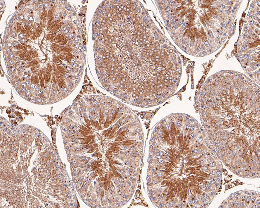 Immunohistochemical analysis of paraffin-embedded rat testis tissue with Rabbit anti-LKB1 antibody (HA500143) at 1/200 dilution.<br />
<br />
The section was pre-treated using heat mediated antigen retrieval with sodium citrate buffer (pH 6.0) for 2 minutes. The tissues were blocked in 1% BSA for 20 minutes at room temperature, washed with ddH2O and PBS, and then probed with the primary antibody (HA500143) at 1/200 dilution for 1 hour at room temperature. The detection was performed using an HRP conjugated compact polymer system. DAB was used as the chromogen. Tissues were counterstained with hematoxylin and mounted with DPX.