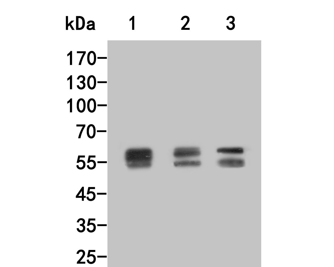 Western blot analysis of Lyn on different lysates. Proteins were transferred to a PVDF membrane and blocked with 5% BSA in PBS for 1 hour at room temperature. The primary antibody (HA500142, 1/1,000) was used in 5% BSA at room temperature for 2 hours. Goat Anti-Rabbit IgG - HRP Secondary Antibody (HA1001) at 1:200,000 dilution was used for 1 hour at room temperature.<br />
Positive control: <br />
Lane 1: 293T cell lysate<br />
Lane 2: A431 cell lysate<br />
Lane 2: Mouse liver tissue lysate