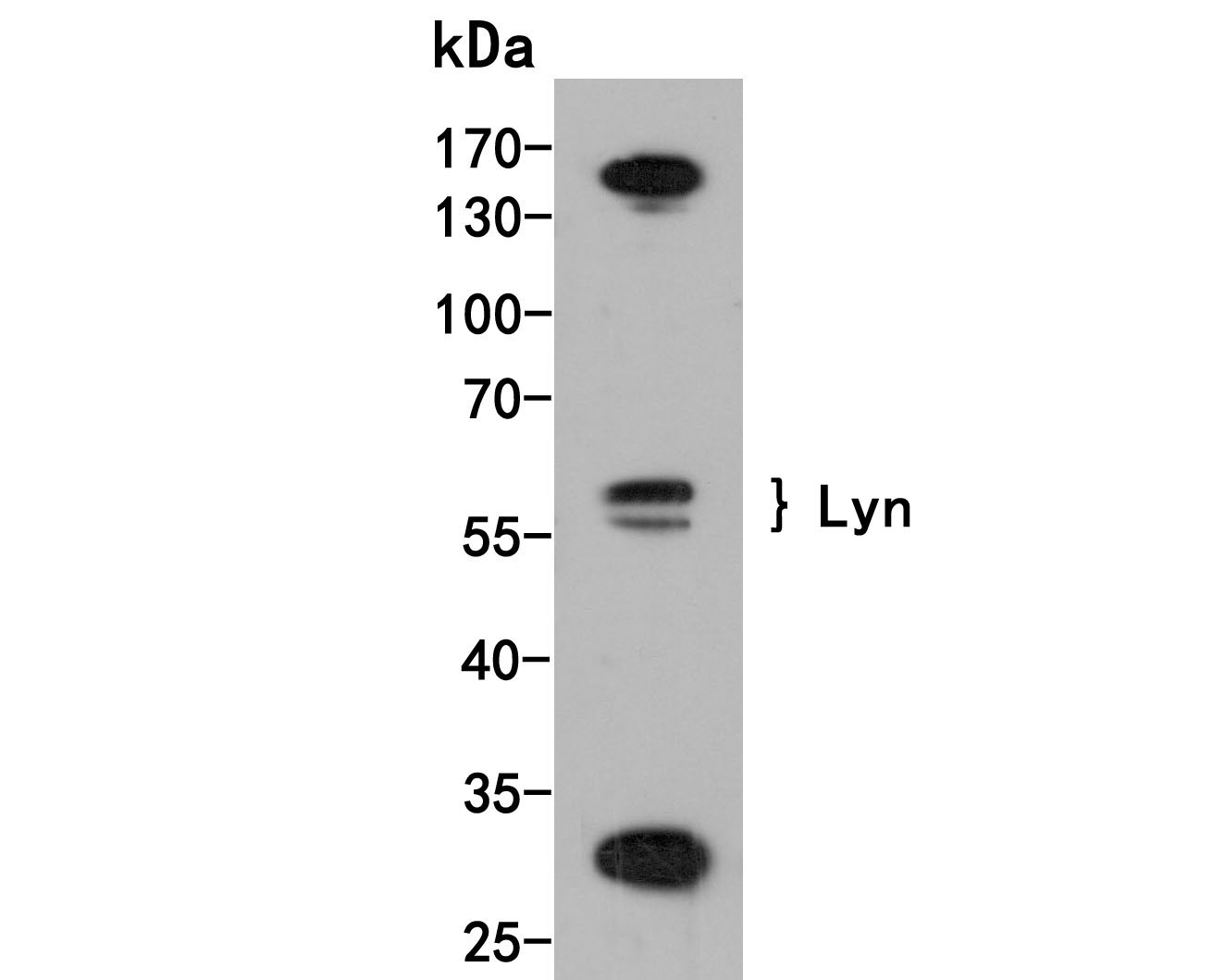 Western blot analysis of Lyn on rat brain tissue lysates. Proteins were transferred to a PVDF membrane and blocked with 5% BSA in PBS for 1 hour at room temperature. The primary antibody (HA500142, 1/1,000) was used in 5% BSA at room temperature for 2 hours. Goat Anti-Rabbit IgG - HRP Secondary Antibody (HA1001) at 1:200,000 dilution was used for 1 hour at room temperature.