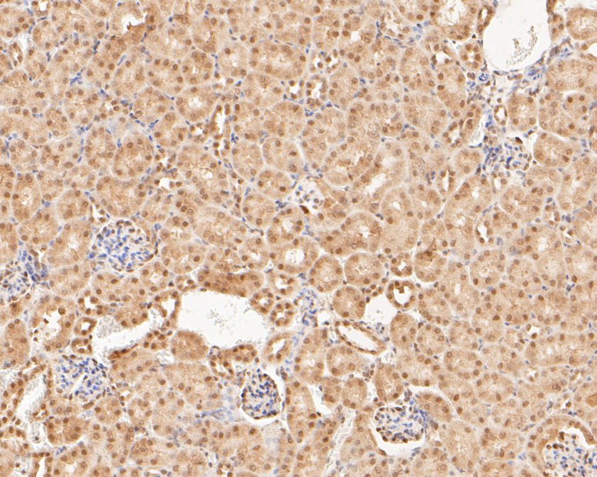 Immunohistochemical analysis of paraffin-embedded mouse kidney tissue using anti-HNRPDL antibody. The section was pre-treated using heat mediated antigen retrieval with sodium citrate buffer (pH 6.0) for 20 minutes. The tissues were blocked in 5% BSA for 30 minutes at room temperature, washed with ddH2O and PBS, and then probed with the primary antibody (HA500146, 1/400)  for 30 minutes at room temperature. The detection was performed using an HRP conjugated compact polymer system. DAB was used as the chromogen. Tissues were counterstained with hematoxylin and mounted with DPX.