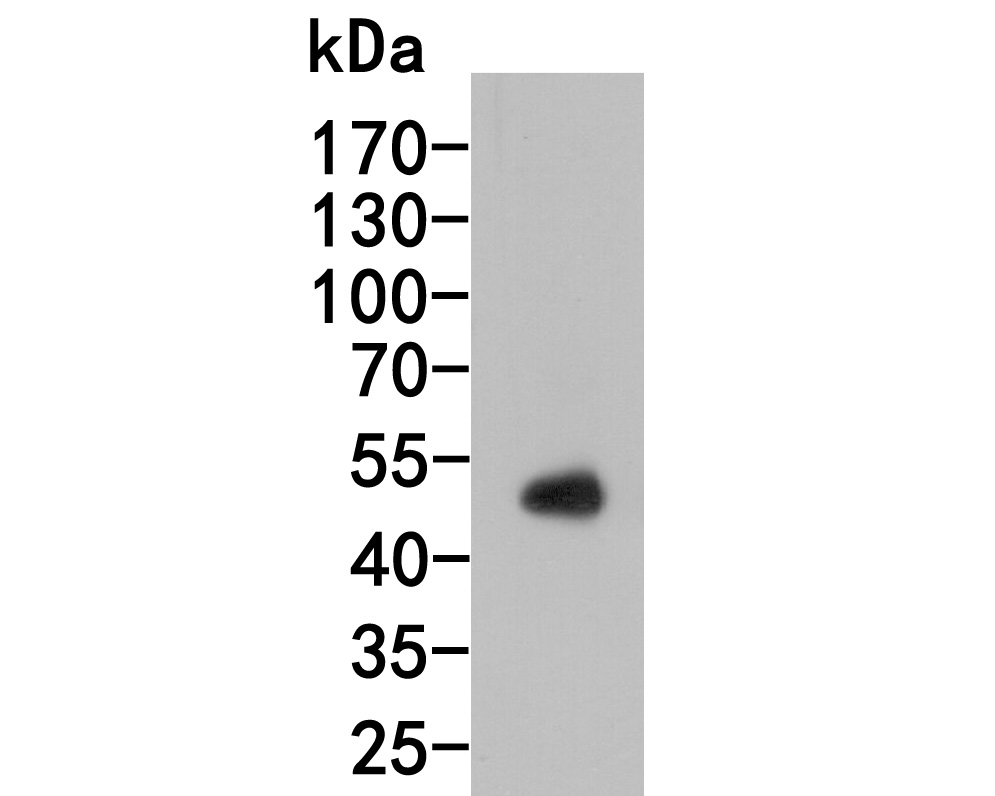 Western blot analysis of Thymidine phosphorylase on human lung tissue lysates. Proteins were transferred to a PVDF membrane and blocked with 5% BSA in PBS for 1 hour at room temperature. The primary antibody (HA600036, 1/1,000) was used in 5% BSA at room temperature for 2 hours. Goat Anti-Mouse IgG - HRP Secondary Antibody (HA1006) at 1:200,000 dilution was used for 1 hour at room temperature.