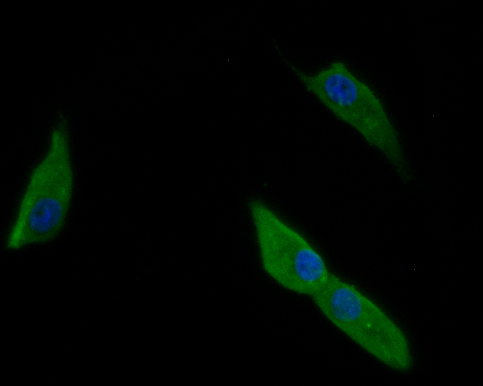 ICC staining of RGMA in MG-63 cells (green). Formalin fixed cells were permeabilized with 0.1% Triton X-100 in TBS for 10 minutes at room temperature and blocked with 1% Blocker BSA for 15 minutes at room temperature. Cells were probed with the primary antibody (HA500148, 1/200) for 1 hour at room temperature, washed with PBS. Alexa Fluor®488 Goat anti-Rabbit IgG was used as the secondary antibody at 1/1,000 dilution. The nuclear counter stain is DAPI (blue).
