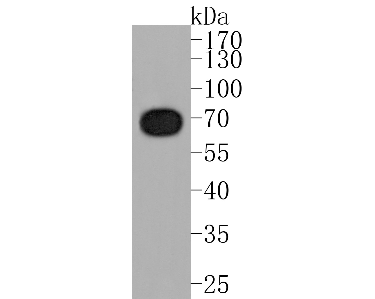 Western blot analysis of TUB on SH-SY5Y cell lysates. Proteins were transferred to a PVDF membrane and blocked with 5% BSA in PBS for 1 hour at room temperature. The primary antibody (HA720035, 1/500) was used in 5% BSA at room temperature for 2 hours. Goat Anti-Rabbit IgG - HRP Secondary Antibody (HA1001) at 1:200,000 dilution was used for 1 hour at room temperature.