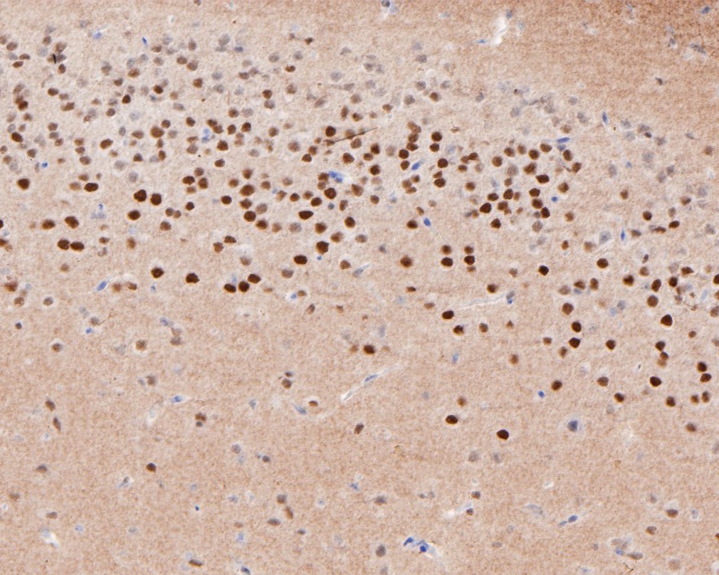 Immunohistochemical analysis of paraffin-embedded mouse brain tissue using anti-TUB antibody. The section was pre-treated using heat mediated antigen retrieval with sodium citrate buffer (pH 6.0) for 20 minutes. The tissues were blocked in 5% BSA for 30 minutes at room temperature, washed with ddH2O and PBS, and then probed with the primary antibody (HA720035, 1/200)  for 30 minutes at room temperature. The detection was performed using an HRP conjugated compact polymer system. DAB was used as the chromogen. Tissues were counterstained with hematoxylin and mounted with DPX.