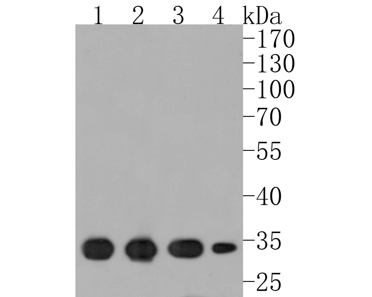 Western blot analysis of ARPC2 on different lysates. Proteins were transferred to a PVDF membrane and blocked with 5% BSA in PBS for 1 hour at room temperature. The primary antibody (HA720030, 1/500) was used in 5% BSA at room temperature for 2 hours. Goat Anti-Rabbit IgG - HRP Secondary Antibody (HA1001) at 1:200,000 dilution was used for 1 hour at room temperature.<br />
Positive control: <br />
Lane 1: THP-1 cell lysate<br />
Lane 2: Jurkat cell lysate<br />
Lane 3: Mouse lung tissue lysate<br />
Lane 4: Mouse kidney tissue lysate