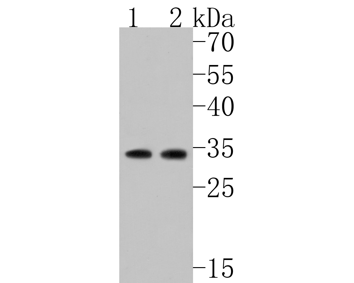 Western blot analysis of ARPC2 on different lysates. Proteins were transferred to a PVDF membrane and blocked with 5% BSA in PBS for 1 hour at room temperature. The primary antibody (HA720030, 1/500) was used in 5% BSA at room temperature for 2 hours. Goat Anti-Rabbit IgG - HRP Secondary Antibody (HA1001) at 1:200,000 dilution was used for 1 hour at room temperature.<br />
Positive control: <br />
Lane 1: Rat heart tissue lysate<br />
Lane 2: Rat kidney tissue lysate