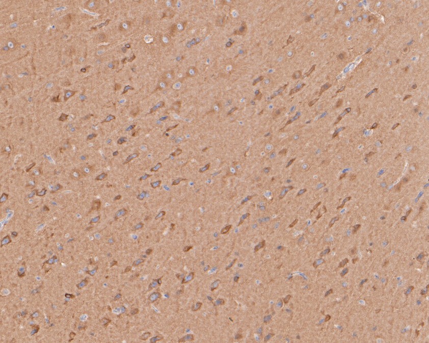 Immunohistochemical analysis of paraffin-embedded rat brain tissue using anti-ARPC2 antibody. The section was pre-treated using heat mediated antigen retrieval with sodium citrate buffer (pH 6.0) for 20 minutes. The tissues were blocked in 5% BSA for 30 minutes at room temperature, washed with ddH2O and PBS, and then probed with the primary antibody (HA720030, 1/200)  for 30 minutes at room temperature. The detection was performed using an HRP conjugated compact polymer system. DAB was used as the chromogen. Tissues were counterstained with hematoxylin and mounted with DPX.