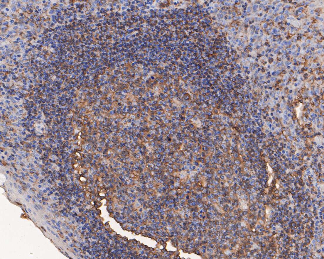 Immunohistochemical analysis of paraffin-embedded human tonsil tissue using anti-ARPC2 antibody. The section was pre-treated using heat mediated antigen retrieval with sodium citrate buffer (pH 6.0) for 20 minutes. The tissues were blocked in 5% BSA for 30 minutes at room temperature, washed with ddH2O and PBS, and then probed with the primary antibody (HA720030, 1/200)  for 30 minutes at room temperature. The detection was performed using an HRP conjugated compact polymer system. DAB was used as the chromogen. Tissues were counterstained with hematoxylin and mounted with DPX.