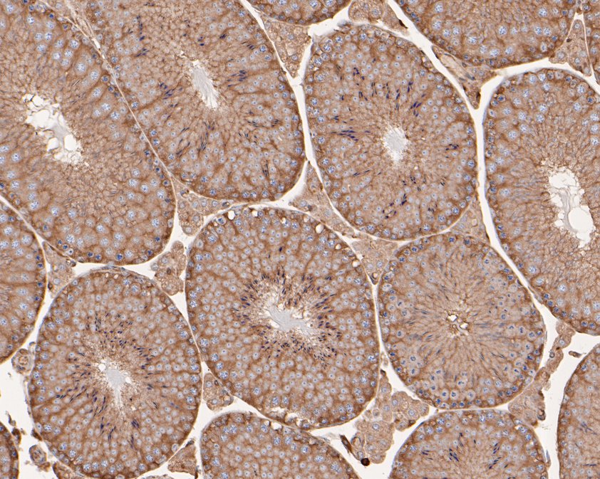 Immunohistochemical analysis of paraffin-embedded mouse testis tissue using anti-ARPC2 antibody. The section was pre-treated using heat mediated antigen retrieval with sodium citrate buffer (pH 6.0) for 20 minutes. The tissues were blocked in 5% BSA for 30 minutes at room temperature, washed with ddH2O and PBS, and then probed with the primary antibody (HA720030, 1/200)  for 30 minutes at room temperature. The detection was performed using an HRP conjugated compact polymer system. DAB was used as the chromogen. Tissues were counterstained with hematoxylin and mounted with DPX.