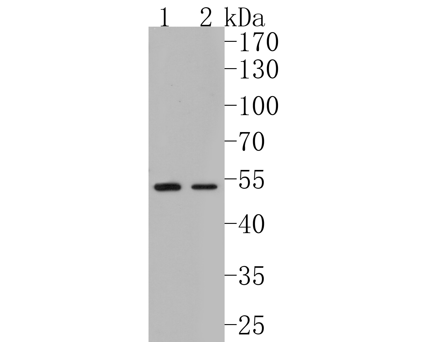 Western blot analysis of Fukutin on different lysates. Proteins were transferred to a PVDF membrane and blocked with 5% BSA in PBS for 1 hour at room temperature. The primary antibody (HA720031, 1/500) was used in 5% BSA at room temperature for 2 hours. Goat Anti-Rabbit IgG - HRP Secondary Antibody (HA1001) at 1:200,000 dilution was used for 1 hour at room temperature.<br />
Positive control: <br />
Lane 1: Jurkat cell lysate<br />
Lane 2: Mouse brain tissue lysate