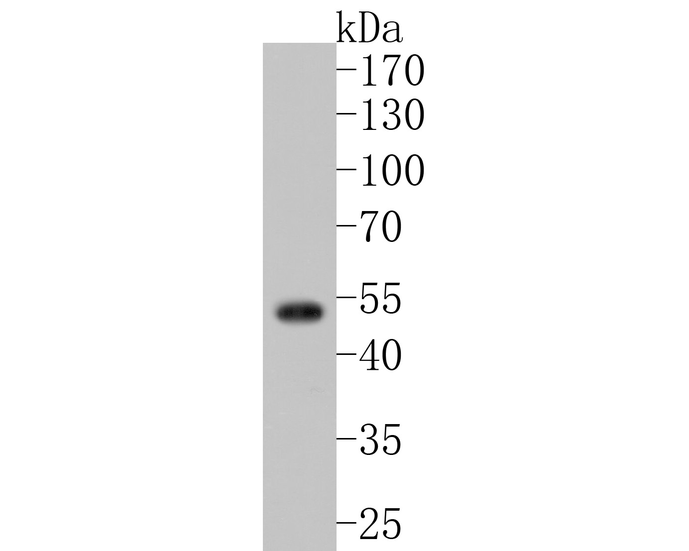 Western blot analysis of Fukutin on rat cerebellum tissue lysates. Proteins were transferred to a PVDF membrane and blocked with 5% BSA in PBS for 1 hour at room temperature. The primary antibody (HA720031, 1/500) was used in 5% BSA at room temperature for 2 hours. Goat Anti-Rabbit IgG - HRP Secondary Antibody (HA1001) at 1:200,000 dilution was used for 1 hour at room temperature.
