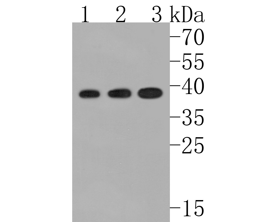 Western blot analysis of ACAT2 on different lysates. Proteins were transferred to a PVDF membrane and blocked with 5% BSA in PBS for 1 hour at room temperature. The primary antibody (HA720032, 1/500) was used in 5% BSA at room temperature for 2 hours. Goat Anti-Rabbit IgG - HRP Secondary Antibody (HA1001) at 1:200,000 dilution was used for 1 hour at room temperature.<br />
Positive control: <br />
Lane 1: Rat testis tissue lysate<br />
Lane 2: Rat liver tissue lysate