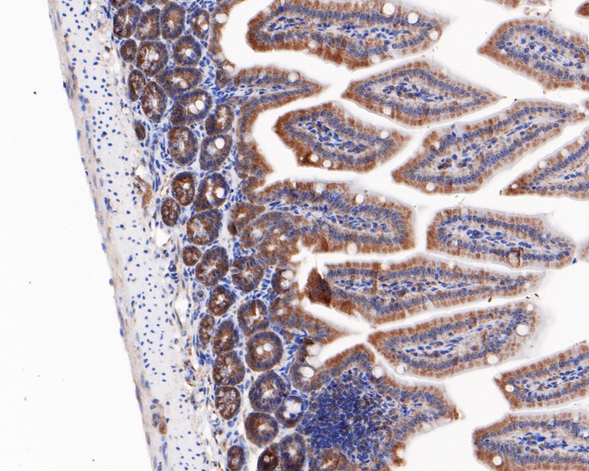 Immunohistochemical analysis of paraffin-embedded mouse colon tissue using anti-ZPR1 antibody. The section was pre-treated using heat mediated antigen retrieval with sodium citrate buffer (pH 6.0) for 20 minutes. The tissues were blocked in 5% BSA for 30 minutes at room temperature, washed with ddH2O and PBS, and then probed with the primary antibody (HA720026, 1/200)  for 30 minutes at room temperature. The detection was performed using an HRP conjugated compact polymer system. DAB was used as the chromogen. Tissues were counterstained with hematoxylin and mounted with DPX.
