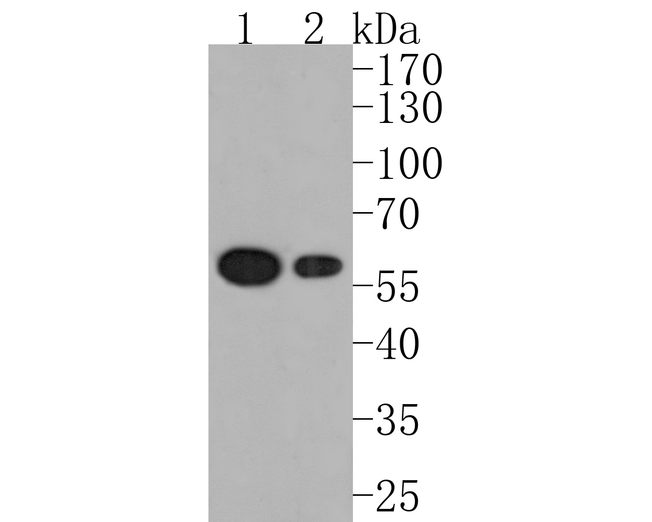 Western blot analysis of PDCD7 on different lysates. Proteins were transferred to a PVDF membrane and blocked with 5% BSA in PBS for 1 hour at room temperature. The primary antibody (HA720033, 1/500) was used in 5% BSA at room temperature for 2 hours. Goat Anti-Rabbit IgG - HRP Secondary Antibody (HA1001) at 1:200,000 dilution was used for 1 hour at room temperature.<br />
Positive control: <br />
Lane 1: Jurkat cell lysate<br />
Lane 2: Hela cell lysate